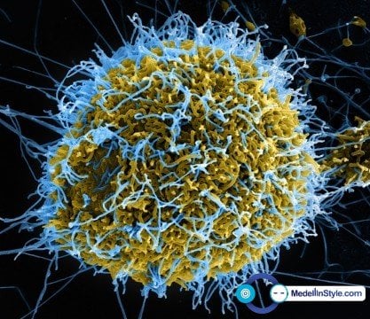 ÉBOLA: ZMapp cura 100% a monos de laboratorio...