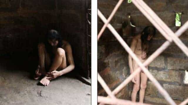 No podían pagarle un tratamiento médico a su hijo y lo encerraron por 30 años en una jaula