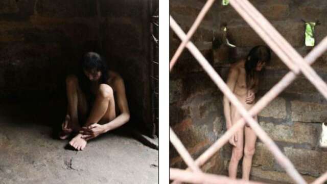 No podían pagarle un tratamiento médico a su hijo y lo encerraron por 30 años en una jaula