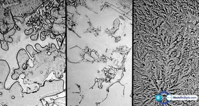 Fractales: Mirar los tipos de lágrimas a través de un microscopio da resultados INCREÍBLES
