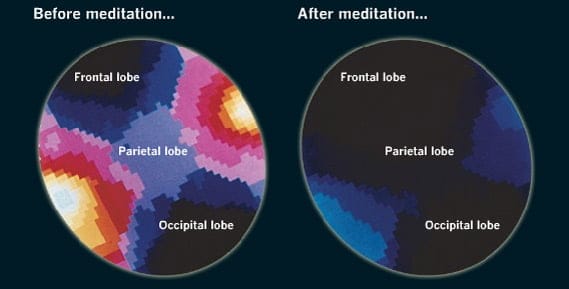 Cómo la meditación modifica tu Cerebro ?