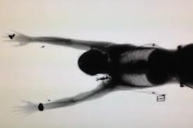 El Raton muerto 5 se expone al cancer en éste Video.