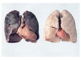 Ciencia: El consumo de cannabis no afecta a la función pulmonar según un amplio estudio