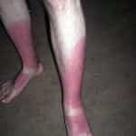 El famoso loco de Coachella