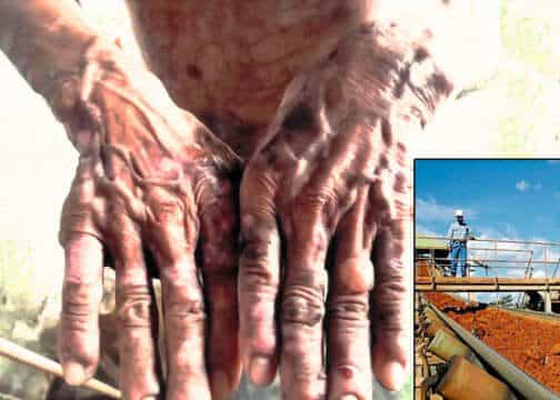 La explotación de Níquel en Cerro Matoso, impactos ambientales y físicos a indigenas en Colombia