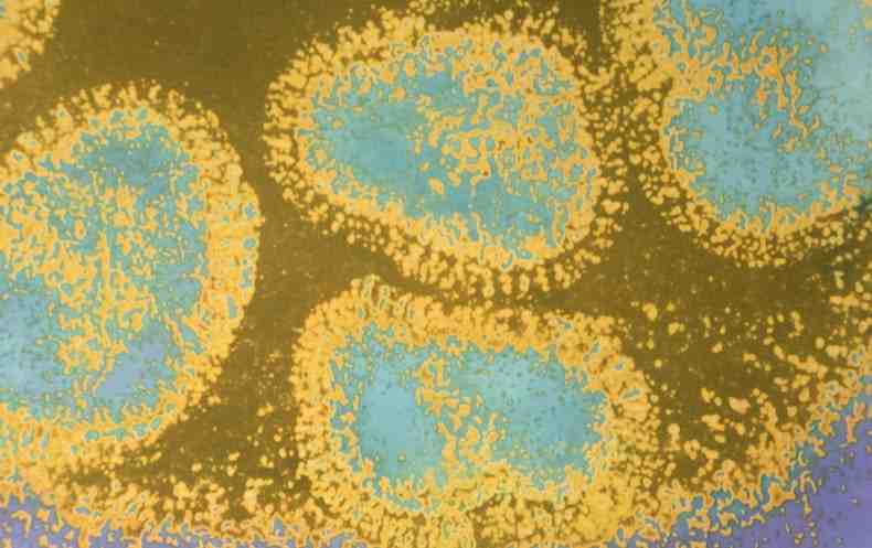 Es el Covid-19 una virus Bio-diseñado ? Abrimos debate