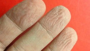 Descubren la utilidad de los dedos arrugados en condiciones húmedas