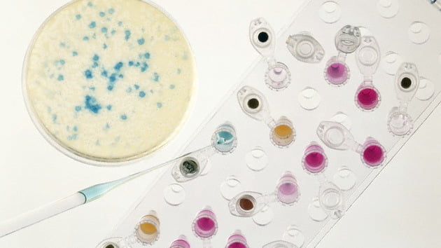 Una nueva bacteria resistente a los antibióticos amenaza a la humanidad