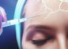 Inyectarse botox en la frente altera la actividad cerebral