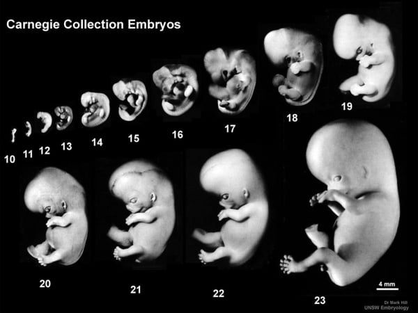 embryos-human