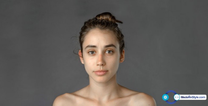 global-beauty-standards-before-and-after-esther-honig-2