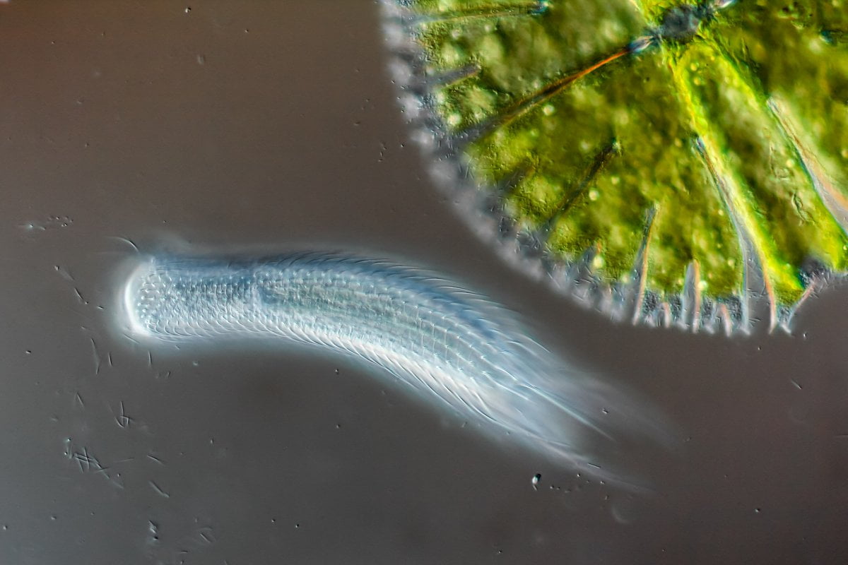 Las mejores fotos Microscópicas del 2015