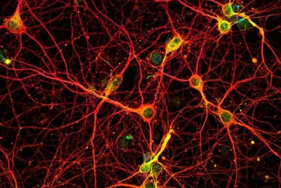 Tenemos neuronas que solo se activan con el canto, Instituto Tecnológico de Massachusetts